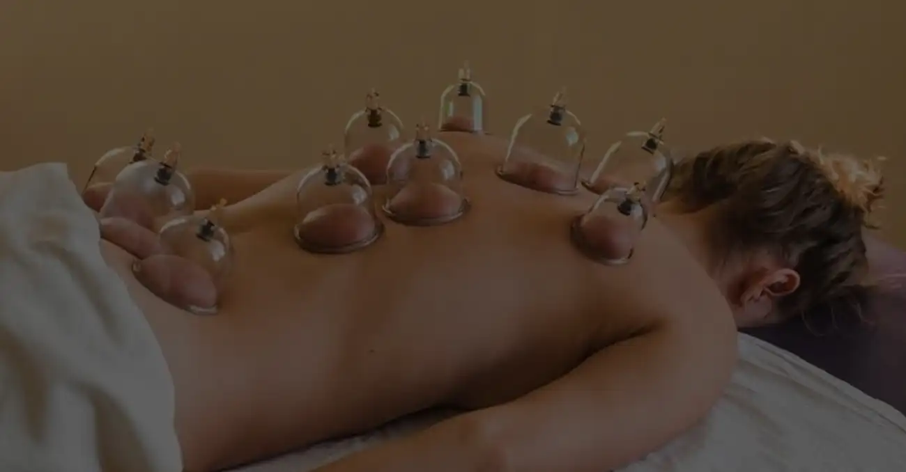 Cupping in Chiswick